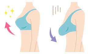 ptôse mammaire causes et solutions aux seins qui tombent